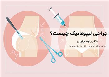 بهترین جراح لیپوماتیک در تهران